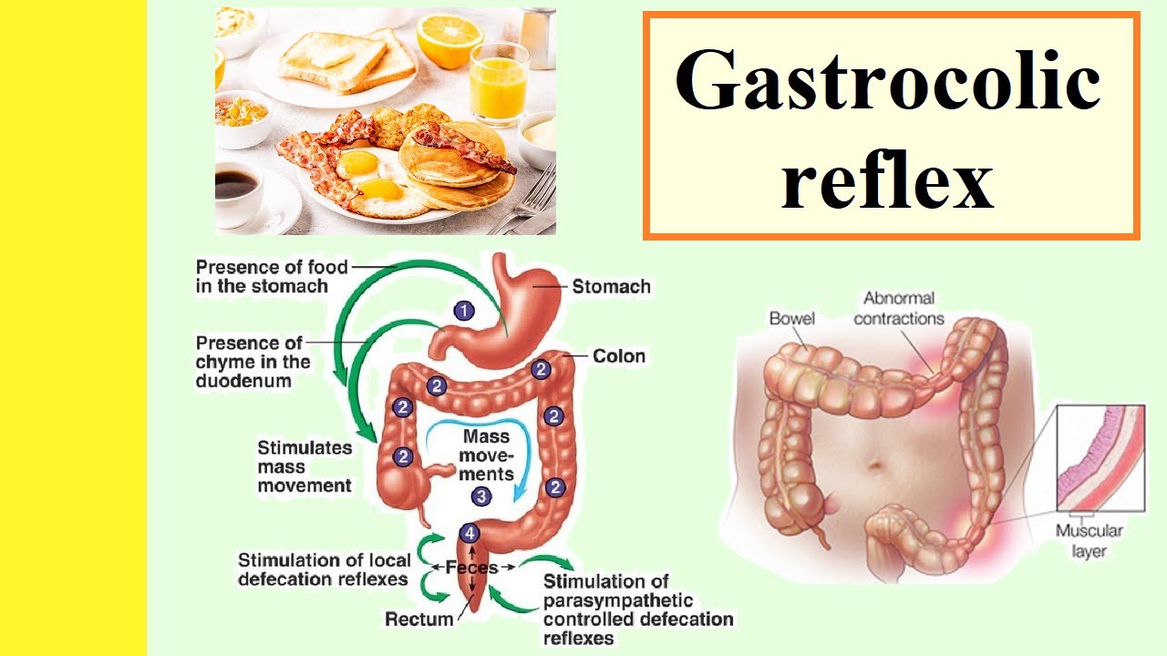 gastrocolic reflex