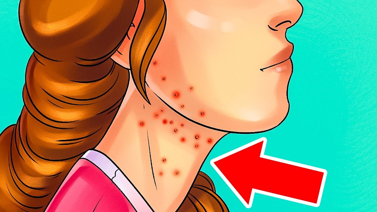 9 Signs You're Eating Too Much Sugar - YouTube