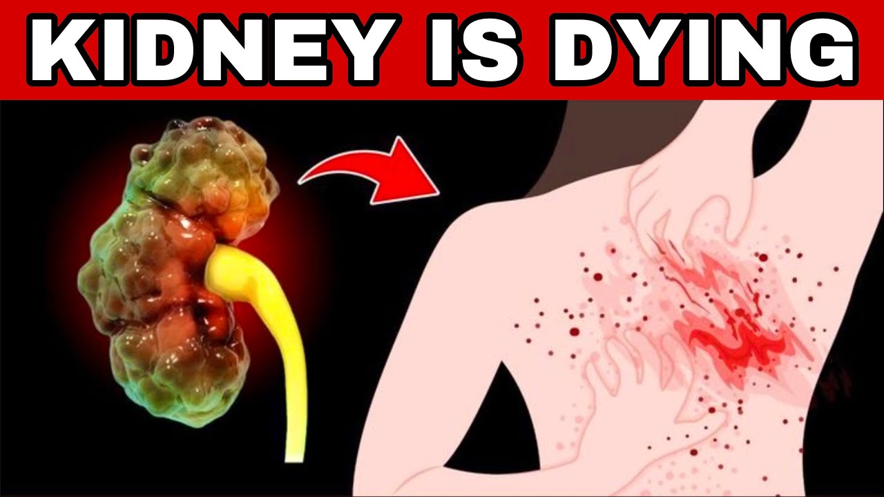 9 Warning Signs Your Body Gives Before Your Kidneys DIE + 8 Urgent Tips to Save Them NOW