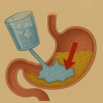 Doctors Reveal That Drinking Cold Water Right After Eating Causes …