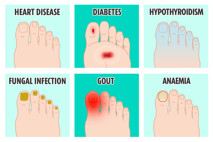 What your feet can reveal about the state of your health - and when to worry