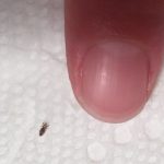 Head lice: How to get rid of them and stop them coming back