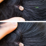 Just discovered this in my son’s hair. What is it? Not sure if we should go to doc