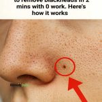 My nana taught me this hack to remove blackheads in 2 mins with 0 work. Here’s how it works