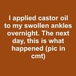 I applied castor oil to my swollen ankles overnight. The next day, this is what happened