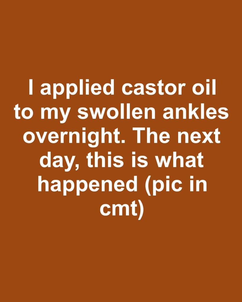 I applied castor oil to my swollen ankles overnight. The next day, this is what happened