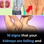 10 Warning Signs Your Kidneys May Be in Serious Danger