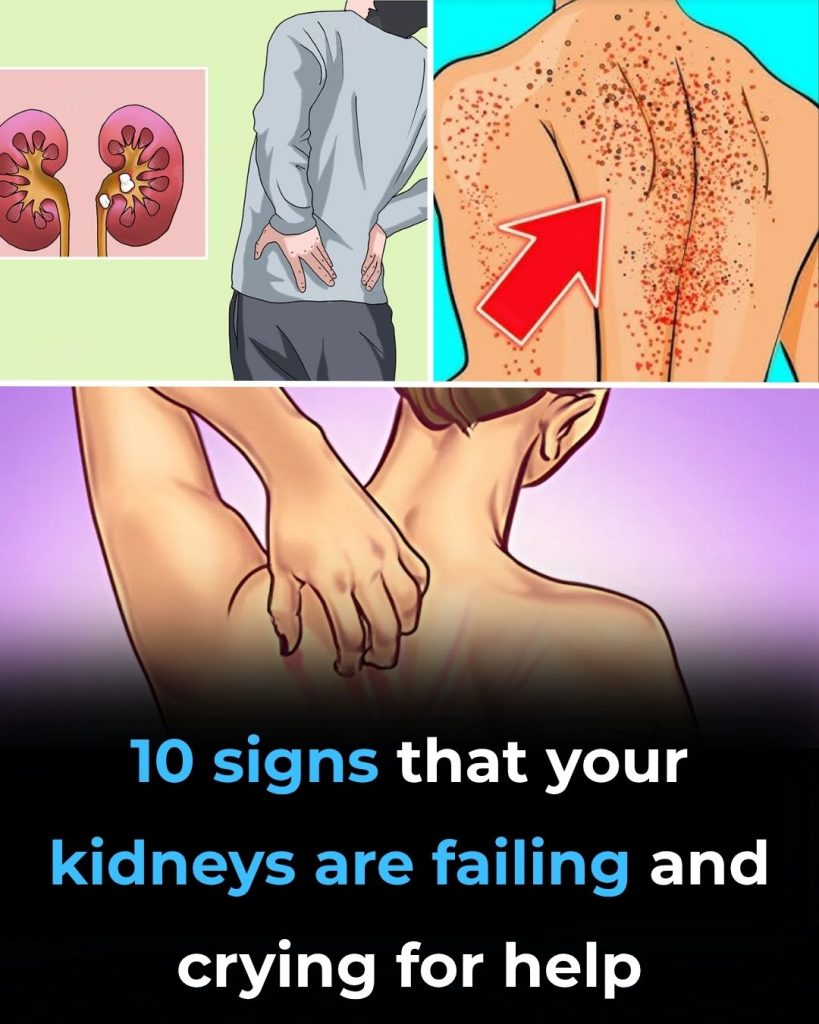 10 Warning Signs Your Kidneys May Be in Serious Danger