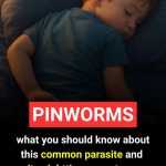 Pinworms in children: what you should know about this common parasite and its nighttime symptoms