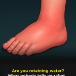 Fluid retention: Body signals that should not be ignored