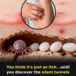 Allergy or Scabies: How to tell the difference and why they are not the same