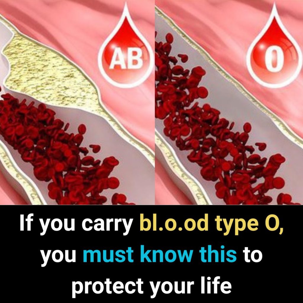 If You Carry Bl.ood Type O, You Must Know This to Protect Your Life