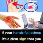 Reasons You Could Have Numbness or Tingling Sensations in Your Hands