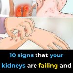 If Your Kidneys Are in Danger, the Body Will Show these 10 Signs