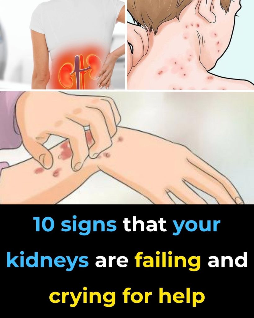 If Your Kidneys Are in Danger, the Body Will Show these 10 Signs