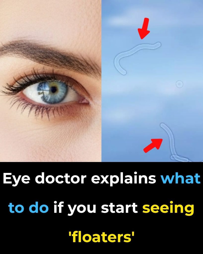 What Are Eye Floaters? Here What To Do If you Start Seeing Them, According to an Eye Doctor