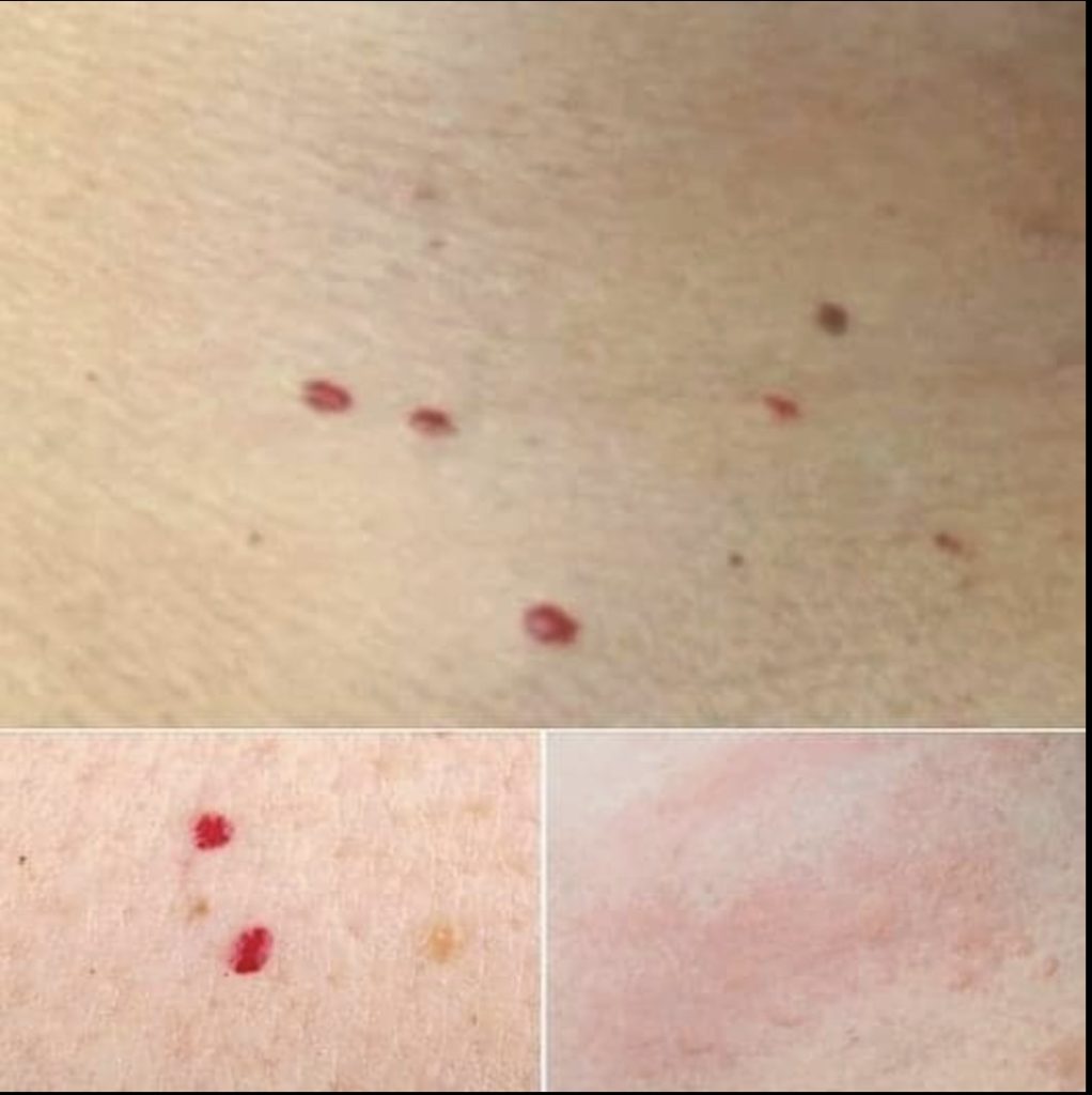 If you spot these red dots on your skin, here’s what they mean