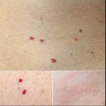 If you spot these red dots on your skin, here’s what they mean