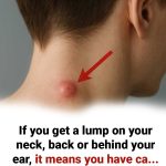 Got a lump on your neck, back or behind your ear? Then you need to know that …