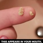 This appears in your mouth, you should be very careful: it can be a war.ning sign