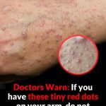 Don’t overlook these small red spots on your arm – They could be important w.arning signs