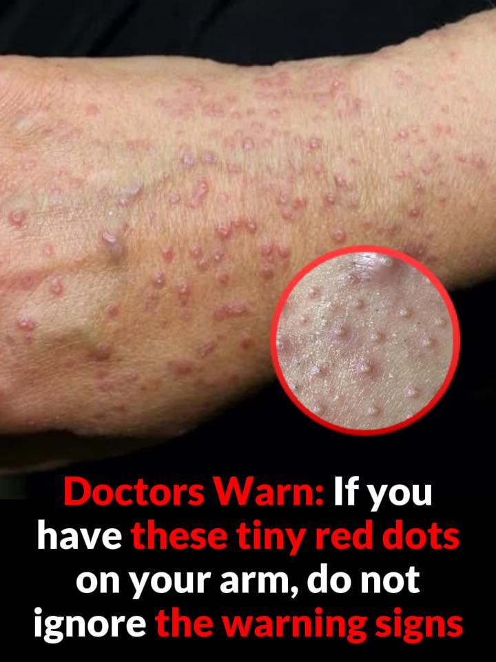 Don’t overlook these small red spots on your arm – They could be important w.arning signs