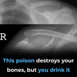 This Drink Will Destroy Your Bones From The Inside But Everyone Drinks It Anyway
