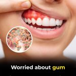 6 Natural Ways To Stop Gum Disease Before It’s Too Late