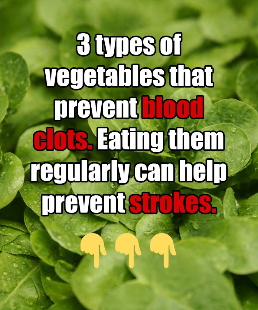 3 types of vegetables that prevent blood clots. Eating them regularly can help prevent strokes.