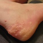 These are the consequences of wearing used…