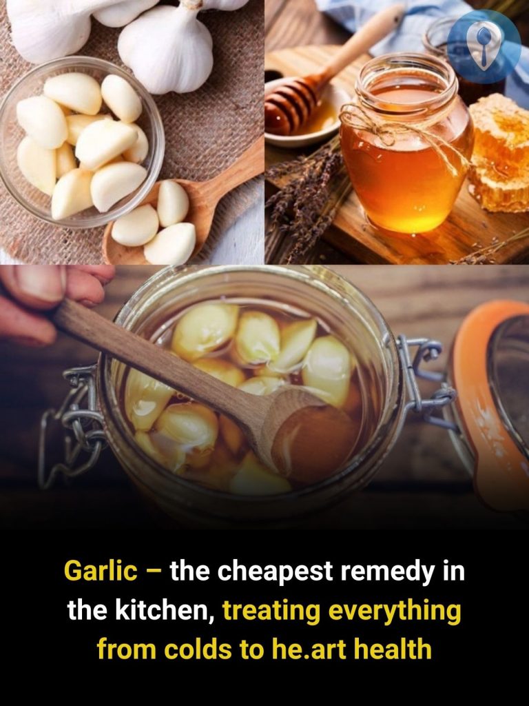 Garlic – the cheapest remedy in the kitchen, treating everything from colds to he.art health