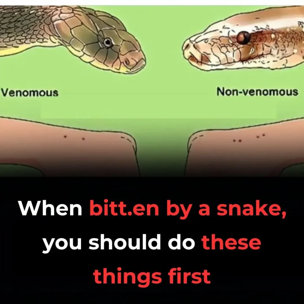 When bitten by a snake, you should do these things first