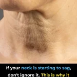 If your neck is starting to sag, don’t ignore it. This is why it happens