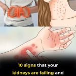 If Your Kidneys Are in Danger, the Body Will Show these 10 Signs