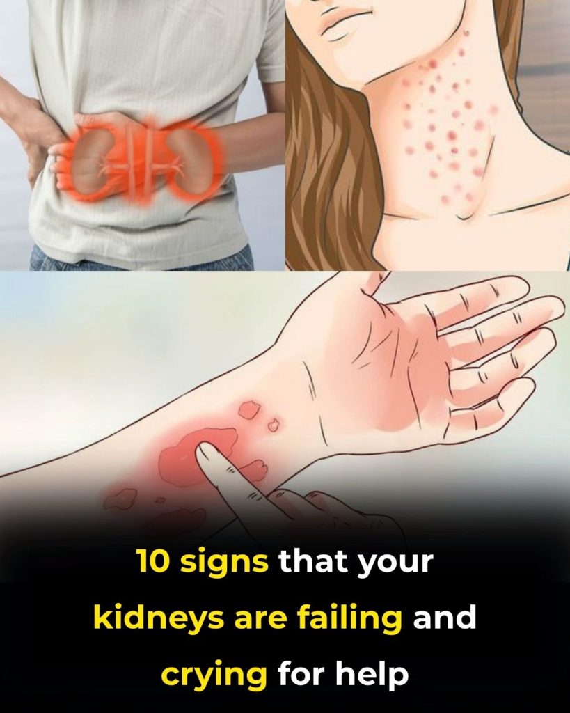 If Your Kidneys Are in Danger, the Body Will Show these 10 Signs