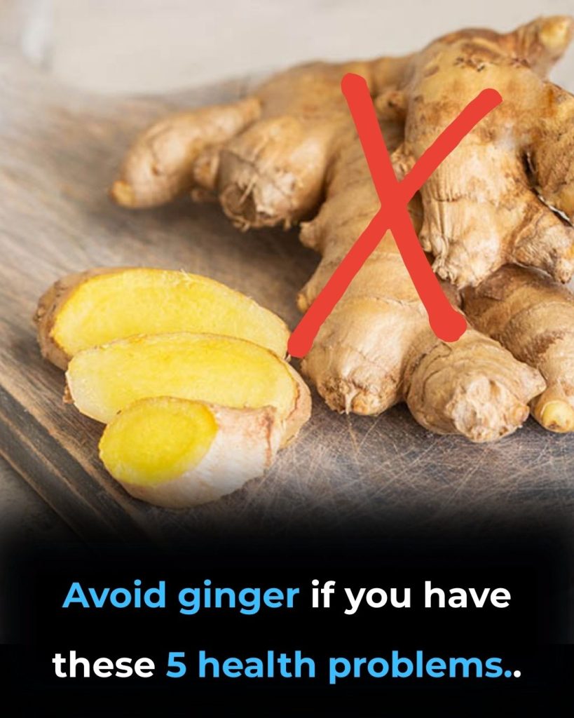 Avoid ginger if you have these 5 health problems..