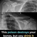 This Drink Will Destroy Your Bones From The Inside But Everyone Drinks It Anyway