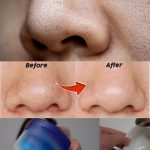 Remove blackheads on your nose with just a mixture of Vaseline and this cheap and easy-to-find ingredient