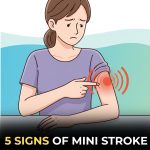 7 Signs of Mini Stroke in The Elderly