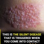 What few people know about this silent disease that can appear without warning