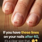 Foods That Support Stronger Nails After 40