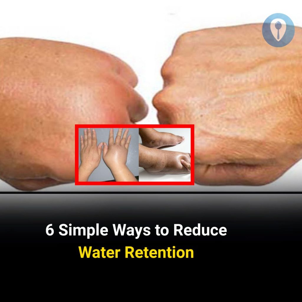 6 Simple Ways to Reduce Water Retention