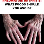 What’s it like living with rheumatoid arthritis? The challenges you face