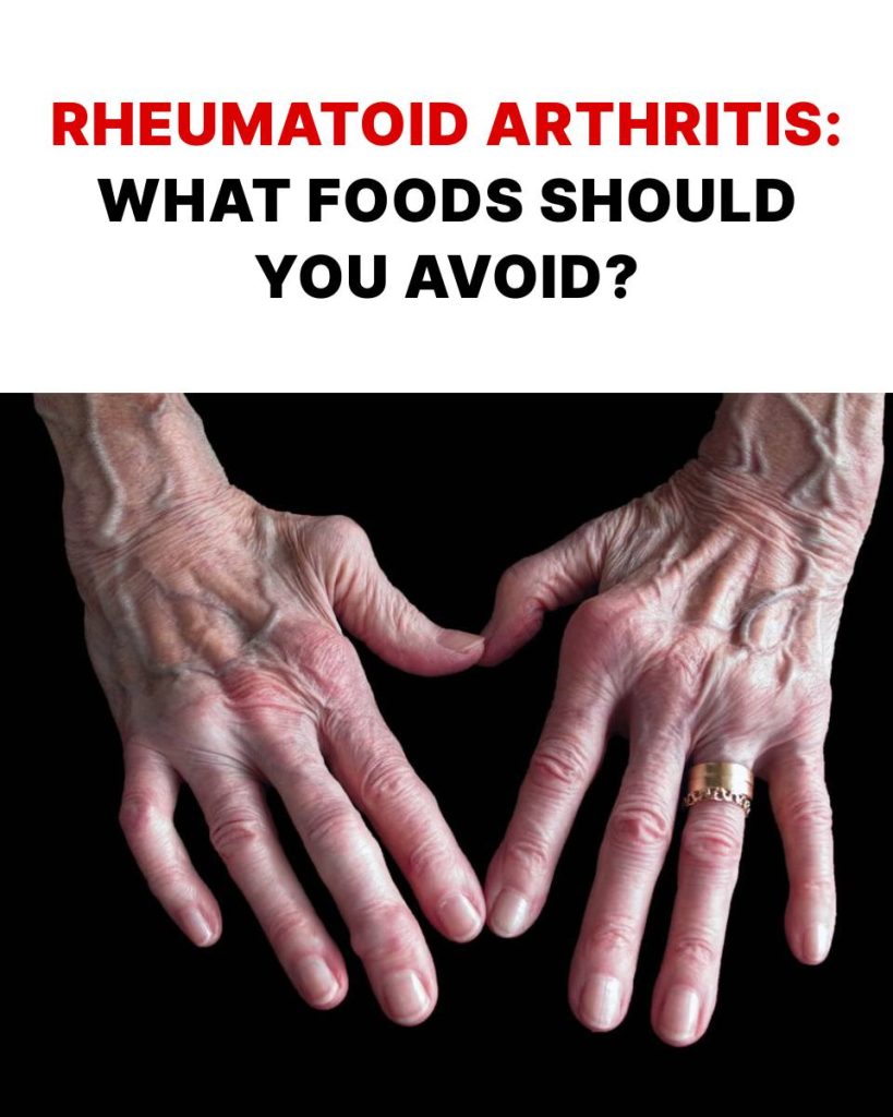 What’s it like living with rheumatoid arthritis? The challenges you face