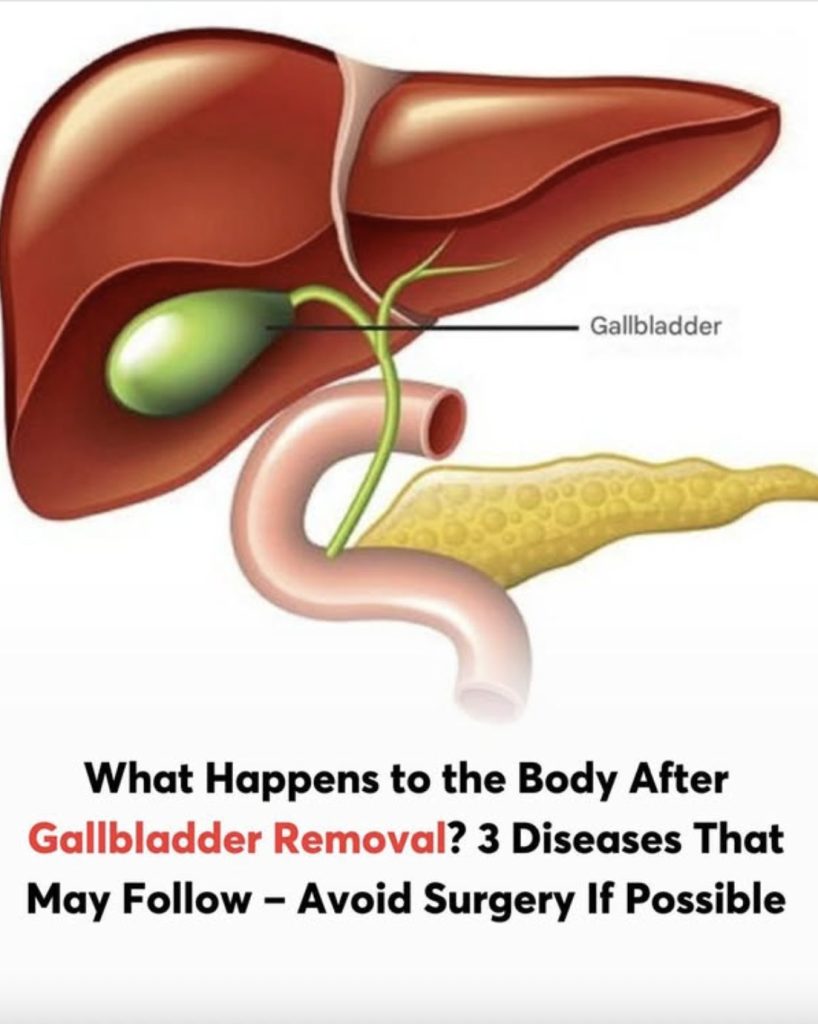 What happens to your body after gallbladder is removed