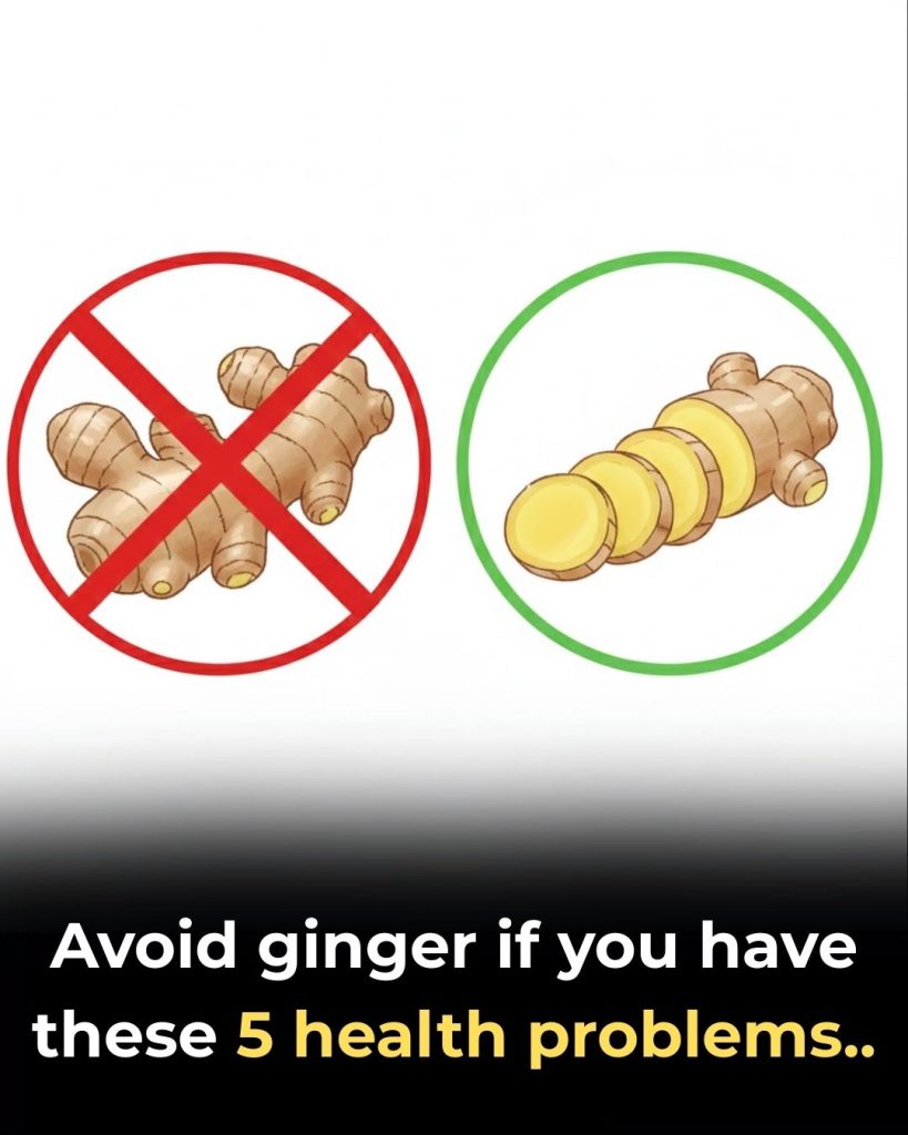 Avoid ginger if you have these 5 health problems..
