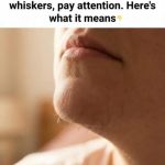 What Chin Hair in Women Really Says About Horm:ones