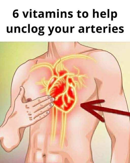 6 vitamins that can help with clogged arteries