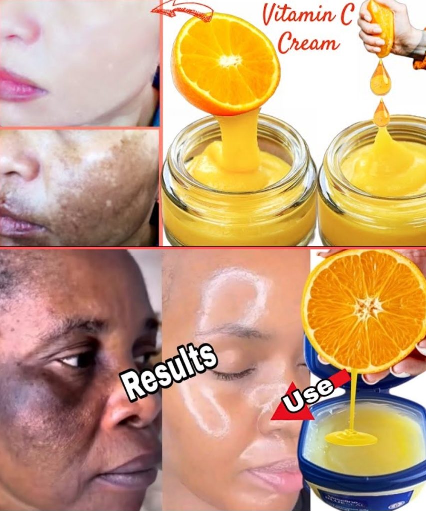 🌟 Brighten Your Skin Naturally: The Truth About Vaseline and Lemon Juice
