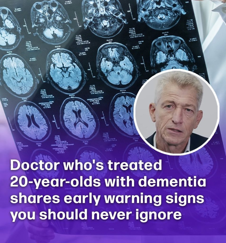 Doctor who’s treated 20-year-olds with dementia shares early warning signs you should never ignore